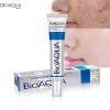 کرم ضد جوش اورژانسی بیواکوا مدل سالیسیلیک اسید BIOAQUA removal of acne