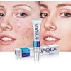 کرم ضد جوش اورژانسی بیواکوا مدل سالیسیلیک اسید BIOAQUA removal of acne